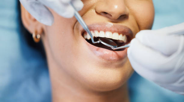Best Emergency Cosmetic Dentistry (e.g., broken veneers) in Roosevelt Gardens, FL